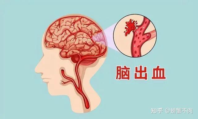 高血压的危害你注意了吗？